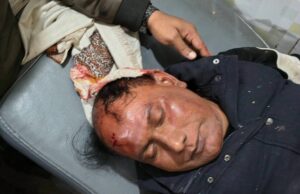 ময়মনসিংহ-১১ (ভালুকা) আসনে নির্বাচনকে কেন্দ্র করে বিএনপি ও স্বতন্ত্র প্রার্থীর সমর্থকদের সংঘর্ষের পর অগ্নিসংযোগ হওয়া একটি দলীয় অফিস ও ঘটনাস্থলে আইনশৃঙ্খলা বাহিনীর উপস্থিতি।