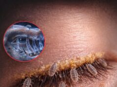 মানুষের চোখের পাপড়ির লোমকূপে থাকা অতি ক্ষুদ্র ডেমোডেক্স মাইটের বৈজ্ঞানিক উপস্থাপন।