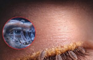 মানুষের চোখের পাপড়ির লোমকূপে থাকা অতি ক্ষুদ্র ডেমোডেক্স মাইটের বৈজ্ঞানিক উপস্থাপন।